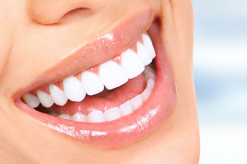 Cosmetic Dentistry in San Antonio