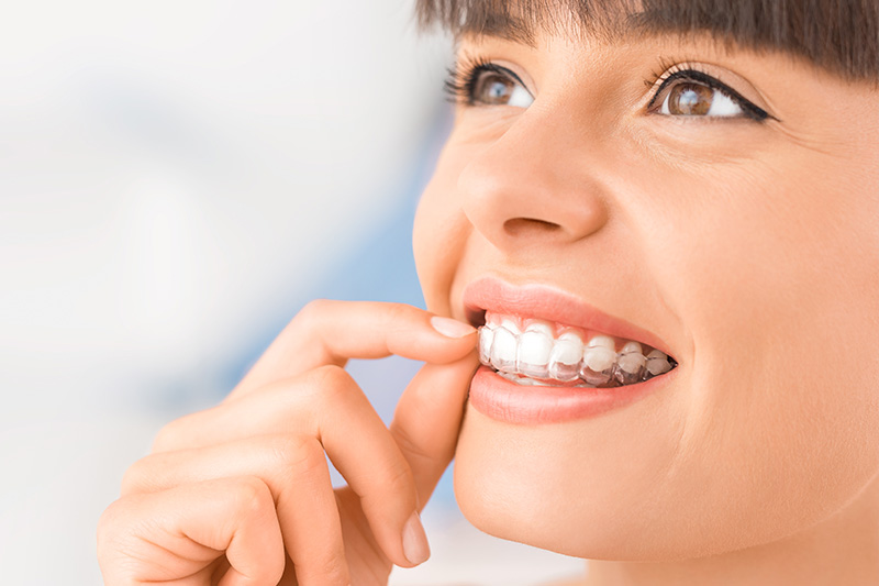 Orthodontics in San Antonio